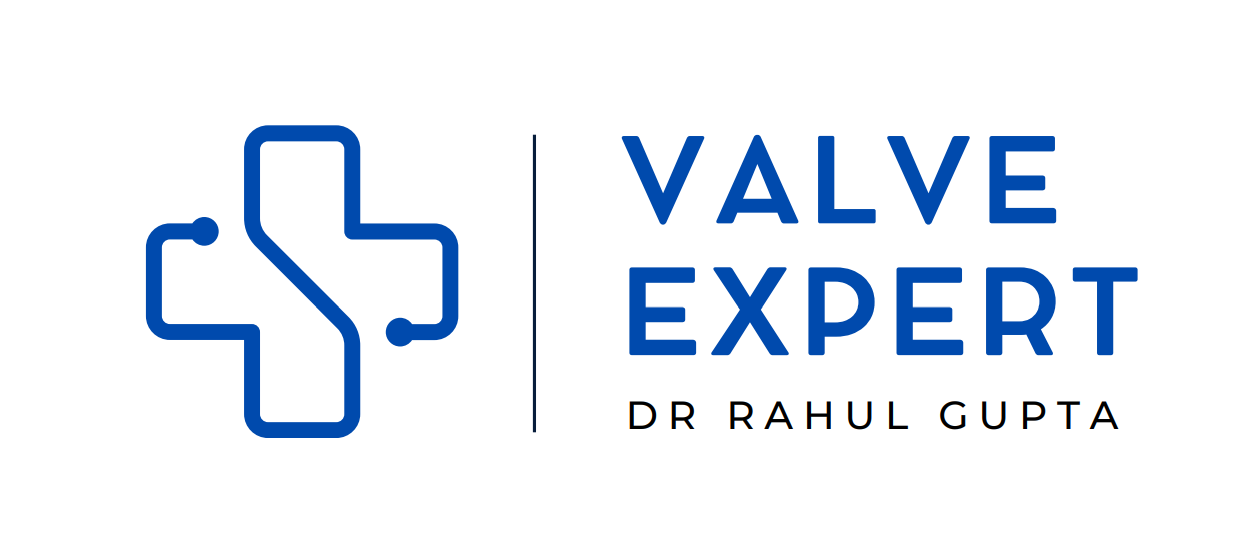 Valve Expert Logo